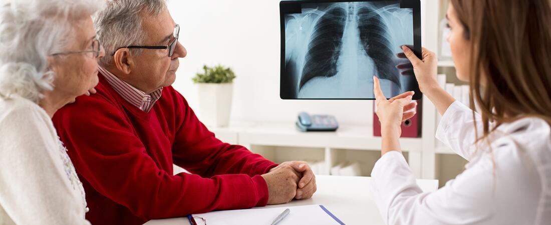 Illustrasjonsbilde av eit eldre par som ser på røntgenbilde saman med ein lege.